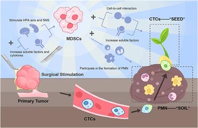 Targeting Myeloid-Derived Suppressor Cells Derived From Surgical Stress: The Key to Prevent Post-surgical Metastasis